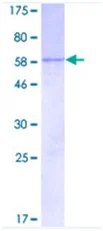 SDS-PAGE - Recombinant Human CISH/CIS protein (GST tag N-Terminus) (AB117057)