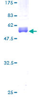 Recombinant Human CITED1 protein