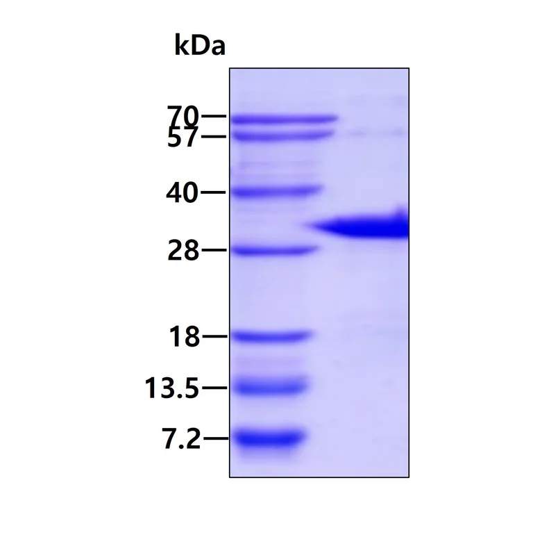 SDS-PAGE - Recombinant Human CITED2 protein (AB87363)