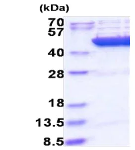 SDS-PAGE - Recombinant Human Citrate synthetase protein (AB183252)