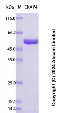SDS-PAGE - Recombinant Human CKAP4 Protein Standard (AB323091)