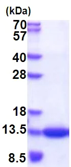 SDS-PAGE - Recombinant Human CKS1 protein (His tag) (AB177620)