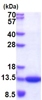 SDS-PAGE - Recombinant Human CKS1 protein (His tag N-Terminus) (AB177620)