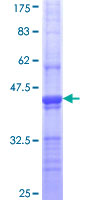 Western blot - Recombinant Human Clathrin heavy chain protein (GST tag N-Terminus) (AB112271)