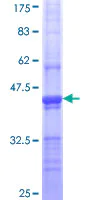 Western blot - Recombinant Human Clathrin heavy chain protein (GST tag N-Terminus) (AB112271)