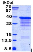 SDS-PAGE - Recombinant Human Clathrin light chain B protein (His tag N-Terminus) (AB130049)