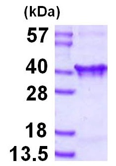 SDS-PAGE - Recombinant Human Clathrin light chain protein (His tag N-Terminus) (AB126693)