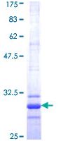 SDS-PAGE - Recombinant Human Claudin 2 protein (AB112383)