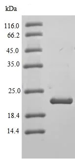 SDS-PAGE - Recombinant Human Claudin 3 protein (Tagged) (AB235064)