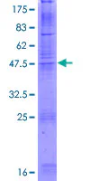 SDS-PAGE - Recombinant Human Claudin 8 protein (AB160326)
