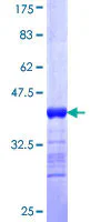 SDS-PAGE - Recombinant Human CLCA1 protein (GST tag N-Terminus) (AB114722)