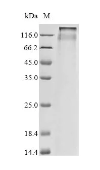 SDS-PAGE - Recombinant Human CLCN3 Protein (His Tag) (AB314616)