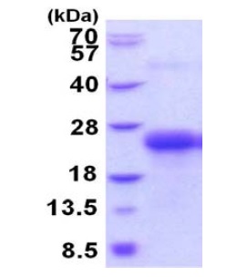 SDS-PAGE - Recombinant Human CLEC-2 protein (denatured) (AB202622), expandable thumbnail