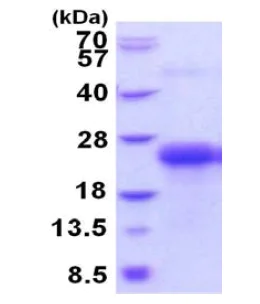 SDS-PAGE - Recombinant Human CLEC-2 protein (denatured) (His tag N-Terminus) (AB202622)