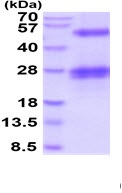 SDS-PAGE - Recombinant Human CLEC-2 protein (His tag) (AB219290)
