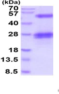 SDS-PAGE - Recombinant Human CLEC-2 protein (His tag) (AB219290)