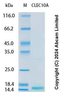 SDS-PAGE - Recombinant Human CLEC10A Protein Standard (His tag) (AB323135)