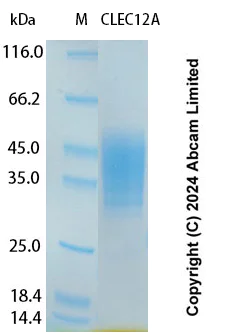 SDS-PAGE - Recombinant Human CLEC12A Protein Standard (His tag) (AB323140)