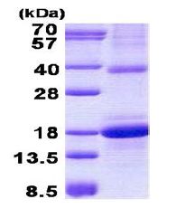 SDS-PAGE - Recombinant Human CLEC2D protein (denatured) (AB140047)