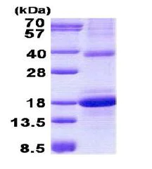 SDS-PAGE - Recombinant Human CLEC2D protein (denatured) (AB140047)