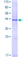 SDS-PAGE - Recombinant Human CLEC2D protein (GST tag N-Terminus) (AB132623)