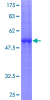SDS-PAGE - Recombinant Human CLEC4A protein (AB162371), expandable thumbnail