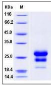 SDS-PAGE - Recombinant Human CLEC4D protein (His tag) (AB276395)