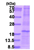 SDS-PAGE - Recombinant Human CLEC5A protein (denatured) (His tag N-Terminus) (AB202186)