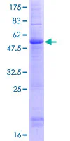 SDS-PAGE - Recombinant Human CLEC9A protein (GST tag N-Terminus) (AB132795)