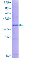 Recombinant Human CLECL1 protein