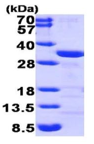 SDS-PAGE - Recombinant Human CLIC1 protein (His tag N-Terminus) (AB95486)