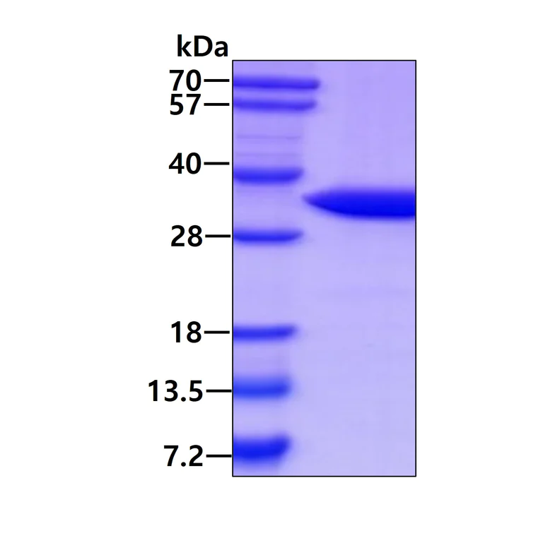 SDS-PAGE - Recombinant Human CLIC2 protein (His tag N-Terminus) (AB106875)