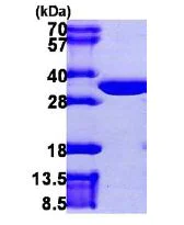 SDS-PAGE - Recombinant Human CLIC2 protein (His tag N-Terminus) (AB106875)