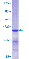 SDS-PAGE - Recombinant Human CLIC5 protein (AB162692)