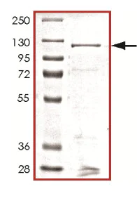SDS-PAGE - Recombinant Human CLLD8/SETDB2 protein (AB169554)