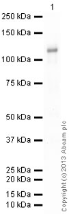 Western blot - Recombinant Human CLLD8/SETDB2 protein (AB169554)