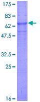 SDS-PAGE - Recombinant Human CLN3 protein (AB132559), expandable thumbnail