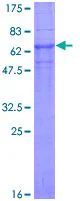 SDS-PAGE - Recombinant Human CLN3 protein (GST tag N-Terminus) (AB132559)