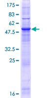 Recombinant Human CLN6 protein