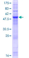 SDS-PAGE - Recombinant Human CLN6 protein (GST tag N-Terminus) (AB162923)