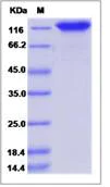 SDS-PAGE - Recombinant Human CLSTN1 protein (His tag) (AB276704)
