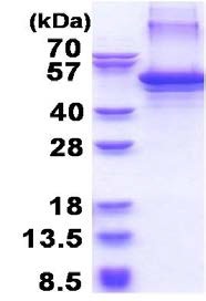 SDS-PAGE - Recombinant Human Clusterin protein (AB177715), expandable thumbnail