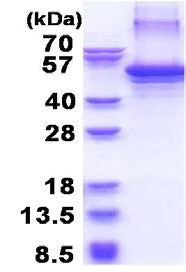 SDS-PAGE - Recombinant Human Clusterin protein (His tag N-Terminus) (AB177715)