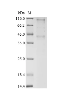 SDS-PAGE - Recombinant Human CMKLR1 Protein (His Tag) (AB314617)