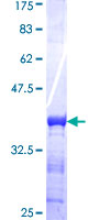 SDS-PAGE - Recombinant Human CMPK2 protein (GST tag N-Terminus) (AB165315)