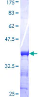 SDS-PAGE - Recombinant Human CMPK2 protein (GST tag N-Terminus) (AB165315)