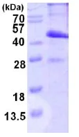 SDS-PAGE - Recombinant Human CMT2 protein (AB123183)