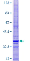 SDS-PAGE - Recombinant Human CMTM1 protein (AB165007)