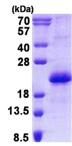 SDS-PAGE - Recombinant Human CNBP protein (His tag N-Terminus) (AB140548)