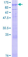 SDS-PAGE - Recombinant Human CNG3 protein (GST tag N-Terminus) (AB132987)